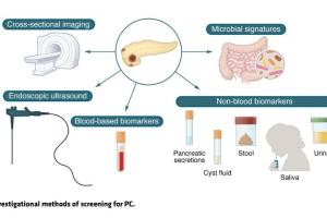 医疗科研新探索 | 菁易科研聚焦：胰腺癌早期检测的挑战与突破