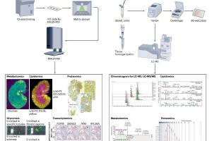 医疗科研新突破｜菁易科研解读空间代谢组学在肾脏疾病精准医疗的应用