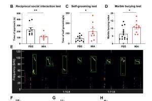 医疗科研新发现 | 菁易科研解读：芬戈莫德如何改善自闭症小鼠硬脑膜淋巴管功能？