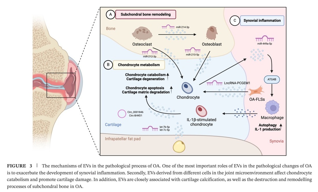 医疗科研新进展 | 菁易科研解读：细胞外囊泡在肌肉骨骼疾病中的作用