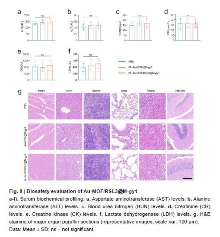 医疗科研新进展 | 菁易科研揭秘：仿生纳米系统如何助力前列腺癌放疗？