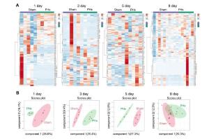 医疗科研新发现 | 菁易科研解读：PCYT2调控助力肝脏部分切除后再生