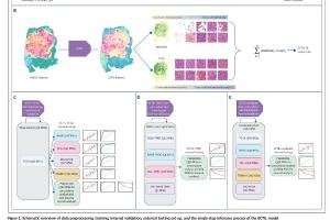 医疗科研新进展 | 菁易科研解析：乳腺癌肿瘤浸润淋巴细胞评估模型的突破