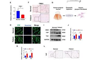 医疗科研新突破 | 菁易科研解读：负载维替泊芬外泌体如何缓解牙龈纤维增生症？