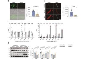 医疗科研新发现 | 菁易科研解读Wnt2抵御心肌缺血再灌注损伤机制