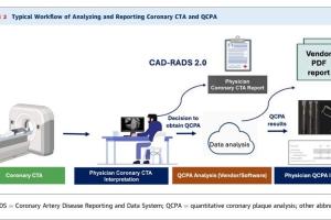 医疗科研新高度 | 定量冠状动脉斑块分析解读，菁易科研深度剖析ACC声明