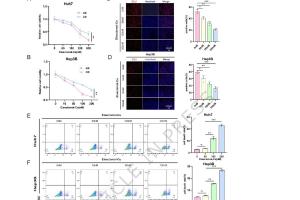 医疗科研新发现 | 菁易科研解读：METTL3如何影响肝癌细胞铜死亡抵抗性？