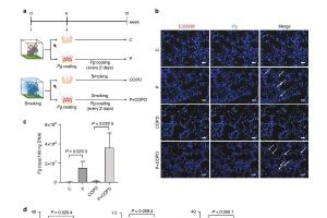 医疗科研新发现 | 菁易科研解读：牙周病原体如何助推慢性阻塞性肺疾病？