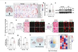 医疗科研新发现 | 菁易科研解读星形胶质细胞信号轴对亨廷顿病的影响