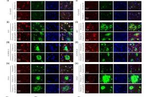 医疗科研新发现 | 菁易科研解读：PINK1 缺陷如何推动路易体痴呆发展？