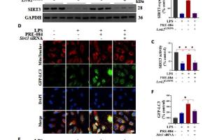 医疗科研新发现 | 菁易科研解读SIGMAR1在急性肺损伤中的保护机制