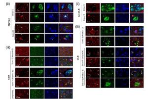 医疗科研新发现 | 菁易科研解读：PINK1 缺陷如何引发路易体痴呆？