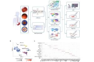 医疗科研新进展 | 菁易科研解读：时空多组学如何揭示早期胃癌关键转折点？