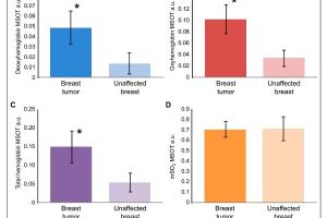 医疗科研新进展 | 菁易科研解析多光谱声断层扫描技术在乳腺肿瘤评估中的应用