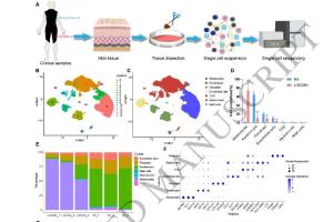 医疗科研新发现 | 菁易科研解读单细胞测序揭秘大型/巨型先天性黑素细胞痣潜在靶点