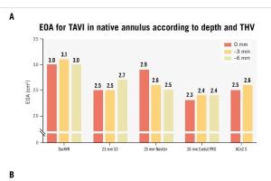医疗科研新进展 | 菁易科研解读：DurAVR经导管瓣膜在TAVI手术中的卓越表现