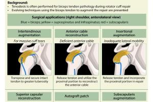 医疗科研新突破 | 菁易科研聚焦：肱二头肌腱在肩袖修复中的创新应用