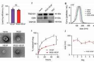 医疗科研新进展 | 菁易科研解读：双功能化细胞外囊泡助力缺血性脑中风修复