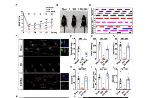 医疗科研新突破 | 菁易科研解读：胆红素如何通过Gas6-Axl信号通路缓解脊髓损伤？