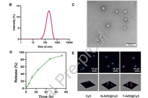 医疗科研新突破 | 菁易科研解读：脂质纳米颗粒助力缺血性中风治疗
