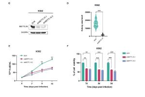 医疗科研新发现 | 菁易科研解读METTL16促进白血病的机制