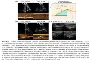 医疗科研新发现 | 菁易科研解读超声评估膈肌与面肩肱型肌营养不良关系