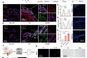 医疗科研新突破 | 菁易科研解读：靶向阻断EVPs缓解骨关节炎的奥秘