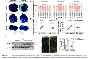 医疗科研新发现 | 菁易科研解读癌细胞分泌miR - 33a促肿瘤发生机制