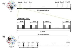 医疗科研新发现 | 菁易科研解读：高频rTMS对最小意识状态患者皮层兴奋性的影响