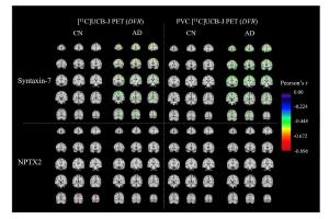 医疗科研新发现 | 菁易科研解读阿尔茨海默病突触病理研究成果