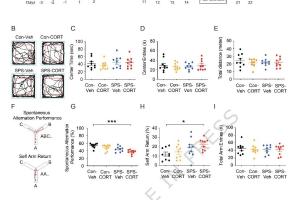 医疗科研新发现 | 菁易科研解读：应激后皮质酮与海马通道对PTSD的影响