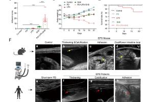 医疗科研新突破 | 菁易科研解读：STING通路在包裹性腹膜硬化中的关键作用