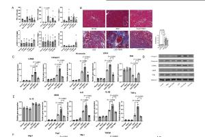 医疗科研新发现 | 菁易科研解读肠道代谢物TMAO促进CKD进展机制