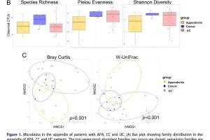 医疗科研新发现 | 菁易科研解读溃疡性结肠炎患者阑尾微环境奥秘
