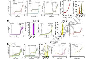 医疗科研新发现 | 菁易科研解读高级氧化蛋白产物激活TRPA1引发疼痛焦虑机制