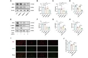 医疗科研新发现 | 菁易科研解读：天麻素如何激活信号通路减轻脑缺血再灌注损伤？