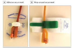 医疗科研干货：福莱导尿管临床管理全解析 | 菁易科研MedUP科研智能体